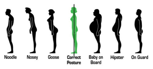 Who Wants Good Posture Anyway? – Why Posture is Important and How to Improve It